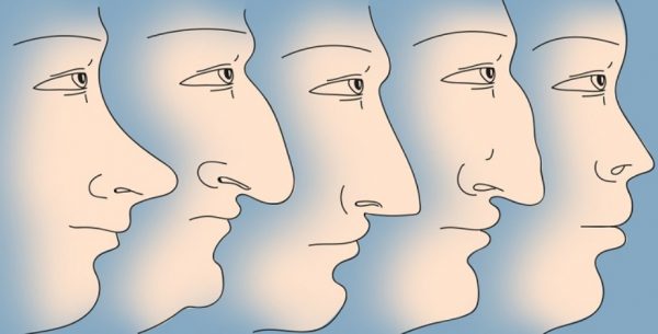 Нос — это самая выдающаяся часть нашего лица, он задает лицу пропорции и создает баланс